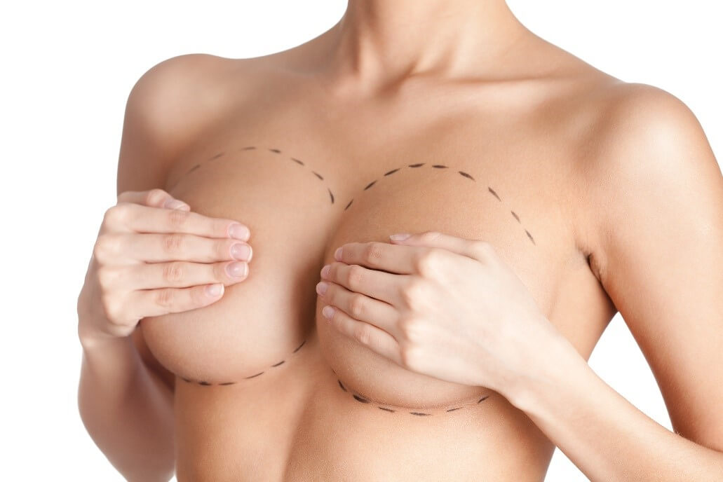 What Does Breast Implant “Profile” Mean?