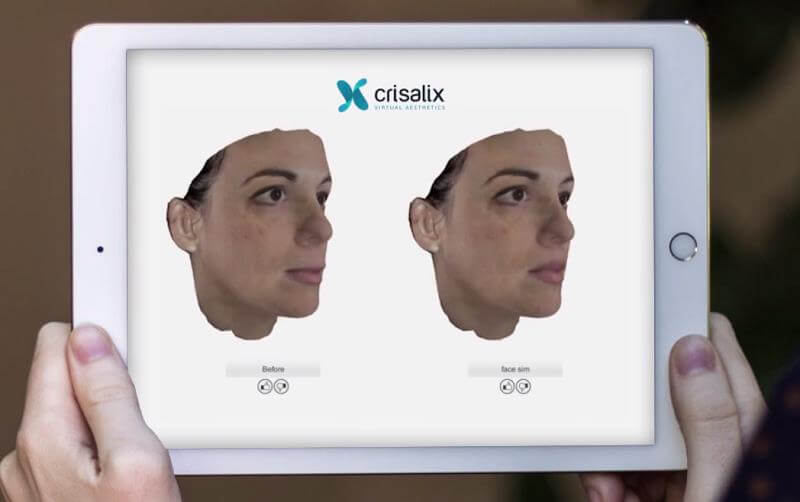 Crisalix 3D Imaging- See Yourself with Plastic Surgery