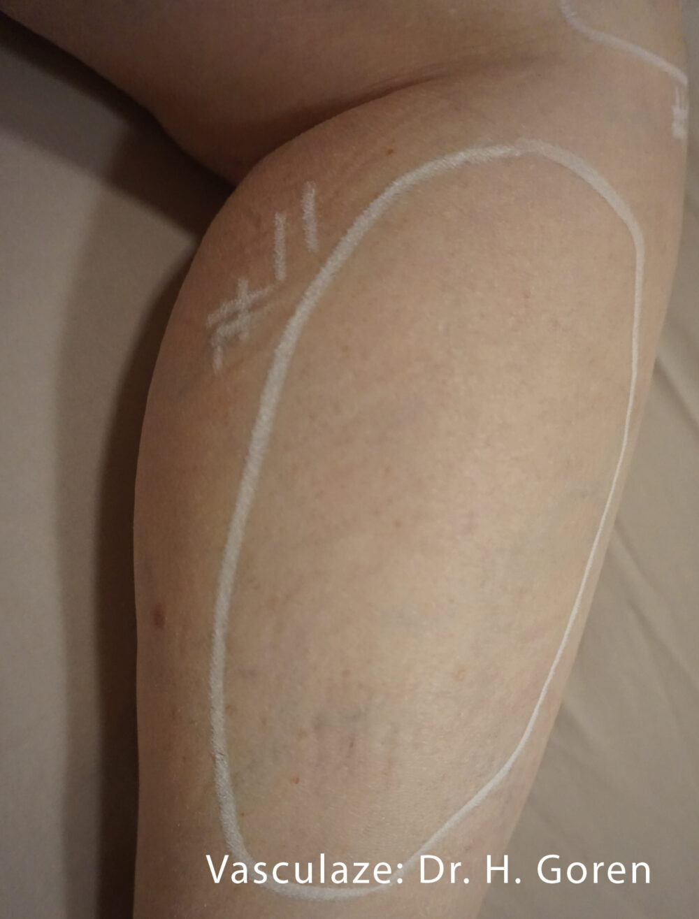 Patient #94568 After Image