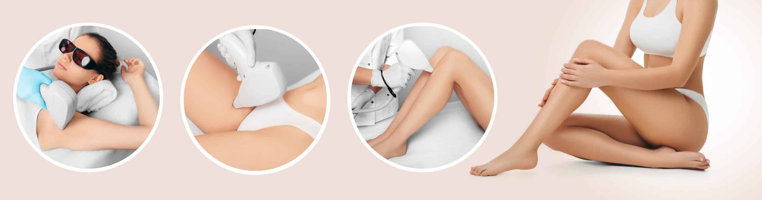 Hair,Remove,Using,Medical,Laser,,Procedure,Body,Epilation.,Technology,Laser