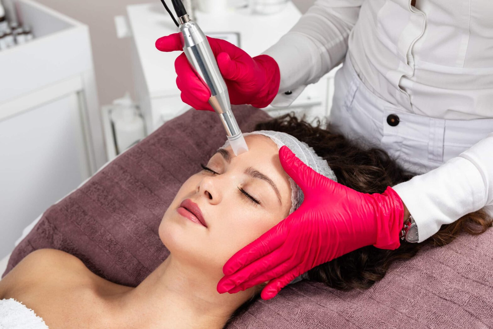 The Benefits of Morpheus8 Microneedling