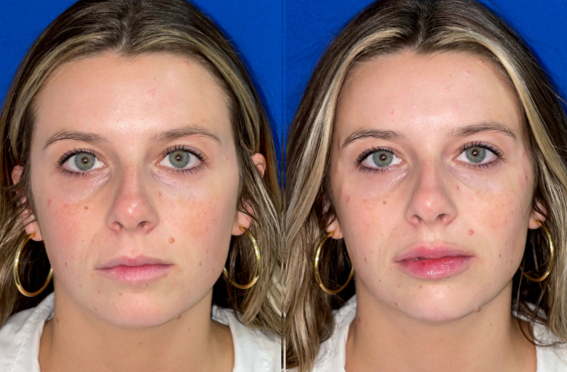 Patient #67413 Combined Image